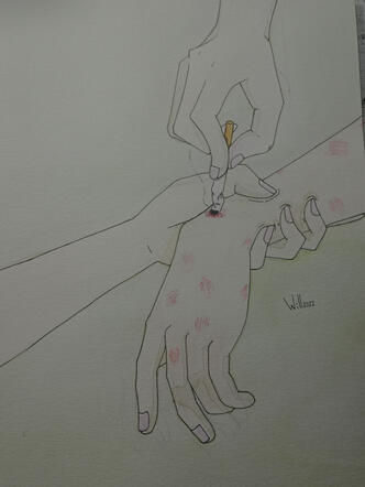 Mano quemada a acuarela